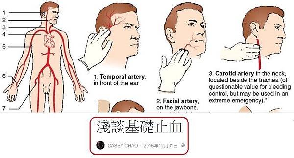 基礎止血