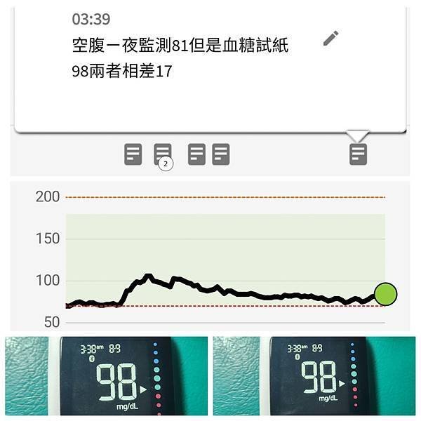 於三個月內四次安裝連續血糖監測(CGM)之心得