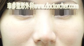 20110119w3_189-1