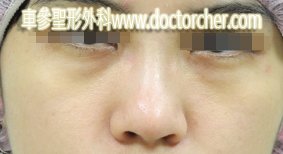 20110217______w4_328-1
