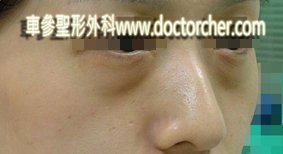 20100814w6 131-1