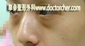 20100814w6 132-1