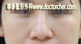DSCN2209-1