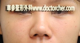 20120102   W1 442拷貝