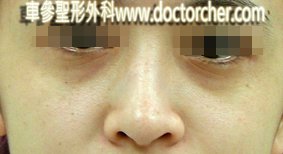20100422w4 098-1