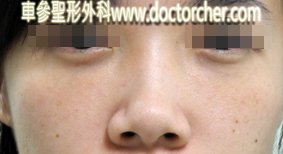 DSCN6872-1