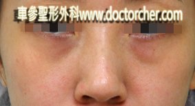 DSCN3686-1