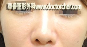 20120524   w4 2038-1