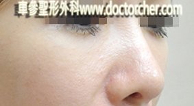 20120524   w4 2045-1