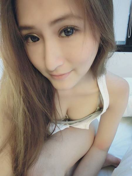 黑眼圈術後追蹤