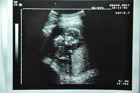 20110810(2).JPG