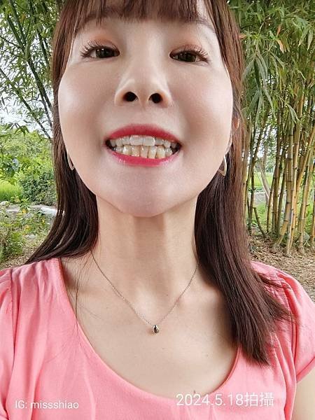 【矯正】煥然一新!跟亂牙說掰掰『段原齒顎矯正牙醫診所-隱適美