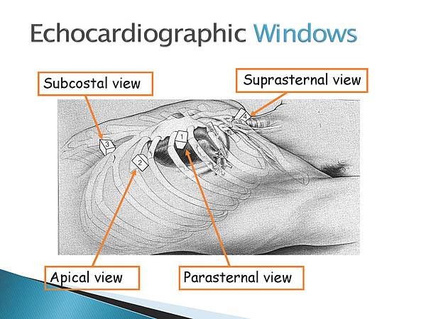 Basic ECHO_2017_handout_Page_05.jpg