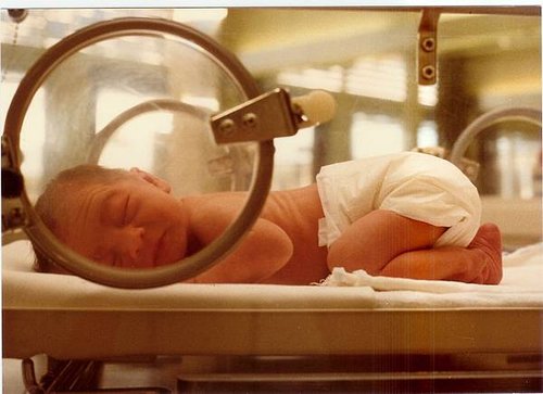 Neonatal_Jacoplane.jpg