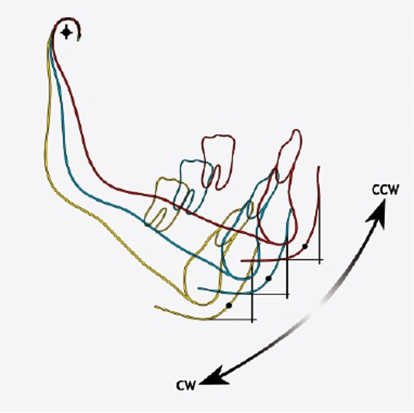 圖三Mandible CCW and CW rotation