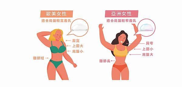 特殊增高型的曼陀女王波義乳，更適合天生胸廓小、纖瘦的亞洲女性用於隆乳手術植入。