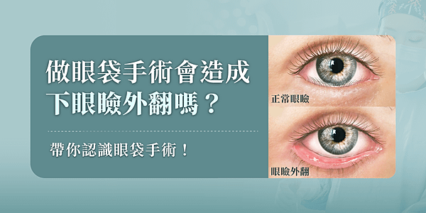 台北眼袋手術鄭穎醫師：做眼袋手術會造成眼瞼外翻嗎？