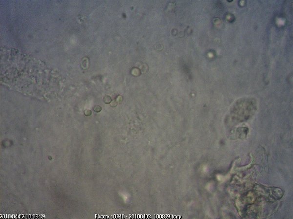 20100331成串紅血球.jpg