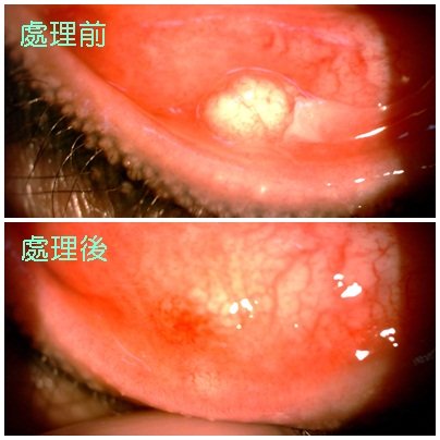貞眼