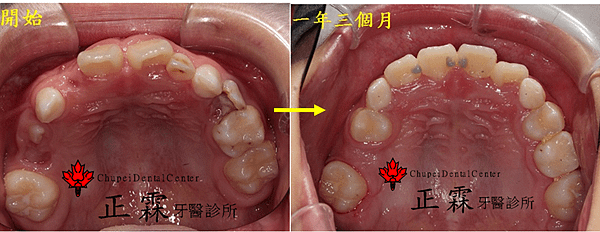 上面完成 擷取.PNG