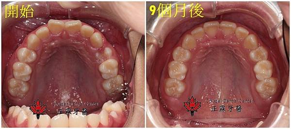 上顎-蔡.jpg