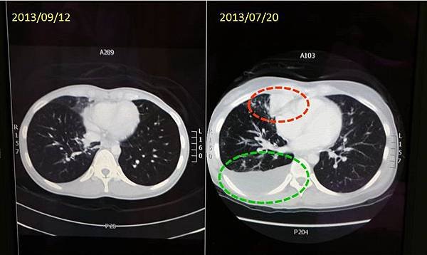 CT(2013.7月&amp;9月)