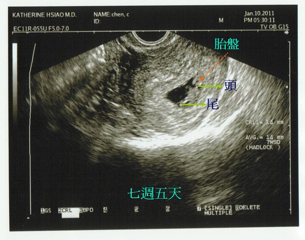 7W5D.bmp