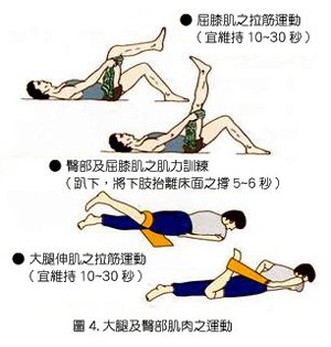 膝蓋長骨刺4