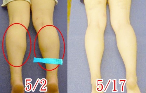 小腿成果 (18).jpg
