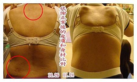 免疫系統 (2).jpg
