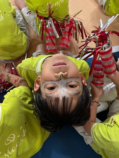 [我的2個小情人] 2024.05 隱適美初體驗