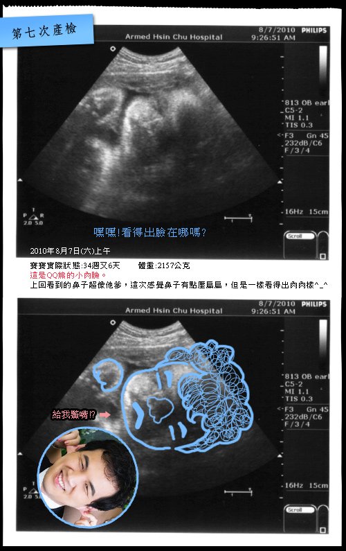 34W+6超音波照.jpg