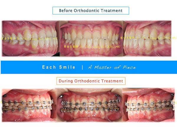 效率與細膩-我的完美矯正 (齊杏齒顎矯正專科)