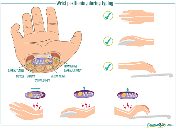 WristAnatomy.png