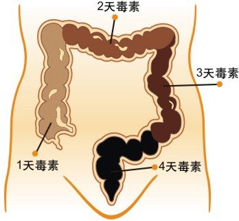 大腸宿便分布圖