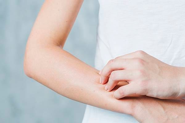 close-up-woman-s-hand-scratching-her-hand.jpg