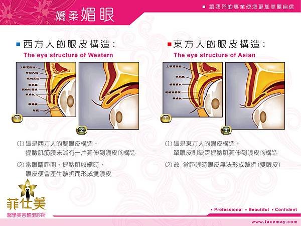 台中縫雙眼皮、割雙眼皮｜菲仕美診所03