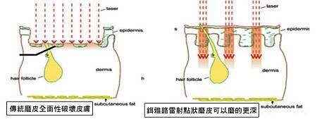 磨皮.jpg