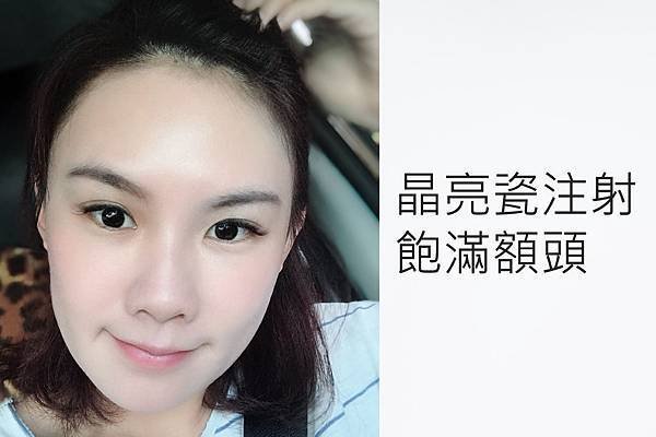 台中微整形│台中醫美推薦│微整形推薦│台中菲仕美整形外科診所