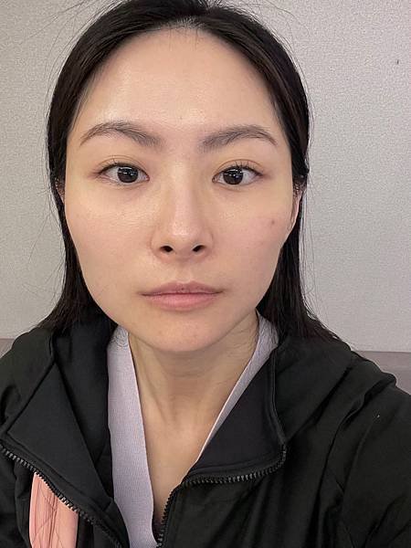台北美顏針醫師推薦承新中醫許舒嵐醫師｜分享我超有感的針灸經驗