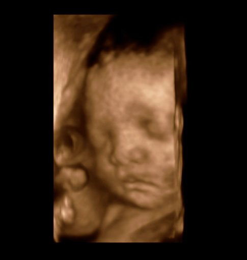 baby1.jpg