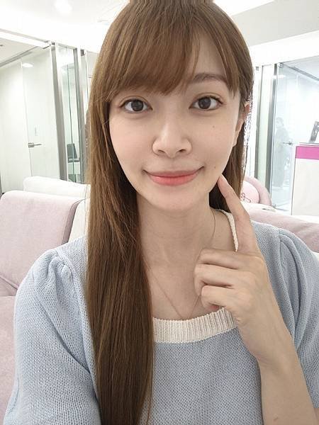 藍鑽魚骨線埋線緊實記錄💕~還妳年輕的秘密~依定美時尚診所