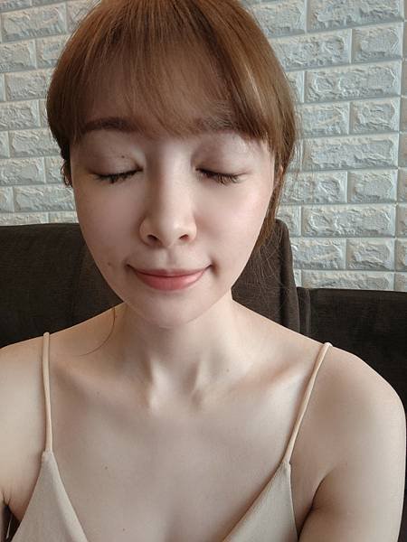 藍鑽魚骨線埋線緊實記錄💕~還妳年輕的秘密~依定美時尚診所