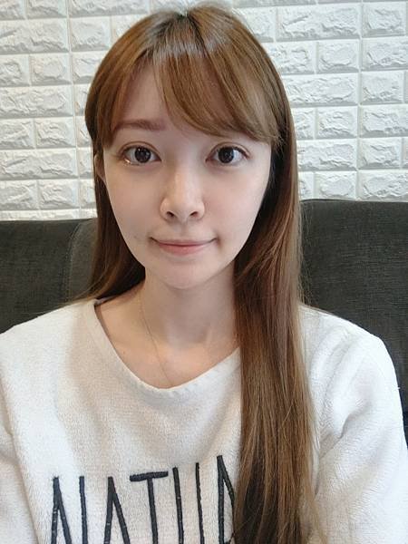 藍鑽魚骨線埋線緊實記錄💕~還妳年輕的秘密~依定美時尚診所