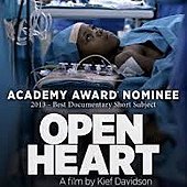 Open Heart