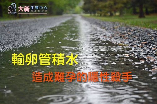 輸卵管積水.jpg