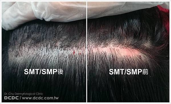SMP照片-1.jpg