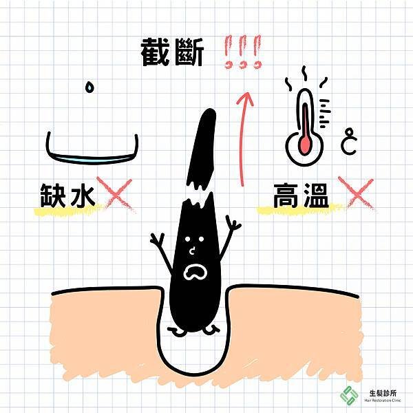 植髮術後重視-2 (1).jpg