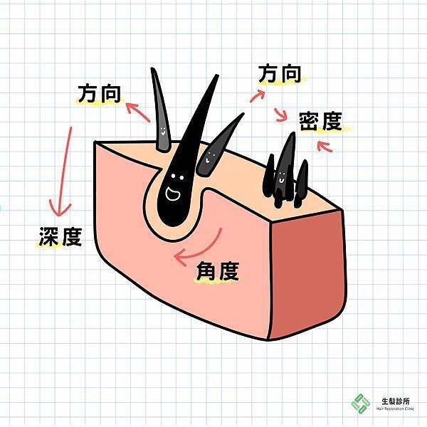 植髮術後重視-4 (1).jpg