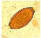trichuris 2